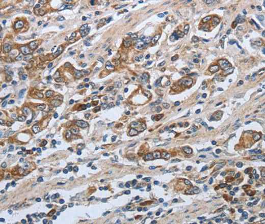 Anti-Human SLC34A2 Antibody
