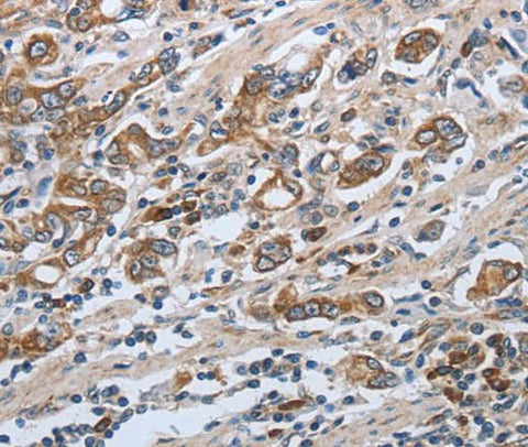 Anti-Human SLC34A2 Antibody - ABMIUM