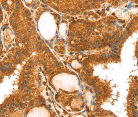 Anti-Human TRIM25 Antibody