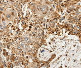Anti-Human/Mouse SLC9A7 Antibody - ABMIUM