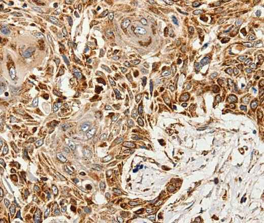 Anti-Human/Mouse SLC9A7 Antibody