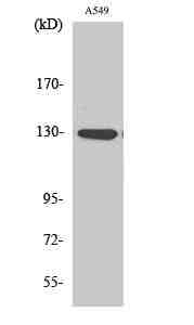 Anti-Human/Mouse/Rat JAK1 (phospho Tyr1022) Antibody
