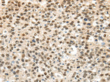 Anti-Human/Mouse/Rat UBA1 Antibody - ABMIUM