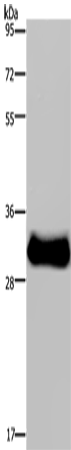 Anti-Human/Mouse FHL3 Antibody - ABMIUM