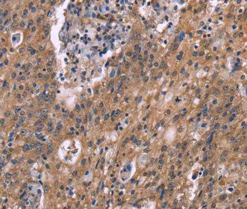Anti-Human HSD11B2 Antibody