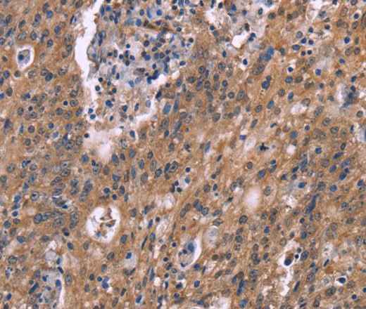 Anti-Human HSD11B2 Antibody