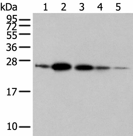 Western blot analysis of 293T A549 and 231 cell Human fetal brain tissue Human placenta tissue using RAB11A Polyclonal Antibody at dilution of 1:500