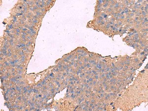 Anti-Human/Mouse/Rat KCNN2 Antibody