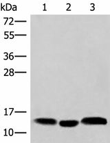 Western blot analysis of Human plasma solution Human placenta tissue Human gastric tissue lysates using HBE1 Polyclonal Antibody at dilution of 1:200