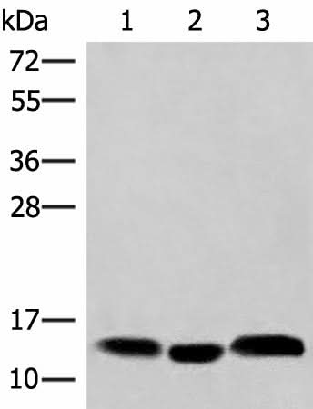 Western blot analysis of Human plasma solution Human placenta tissue Human gastric tissue lysates using HBE1 Polyclonal Antibody at dilution of 1:200