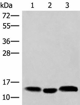Western blot analysis of Human plasma solution Human placenta tissue Human gastric tissue lysates using HBE1 Polyclonal Antibody at dilution of 1:200