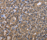 Anti-Human/Mouse GADD45B Antibody - ABMIUM