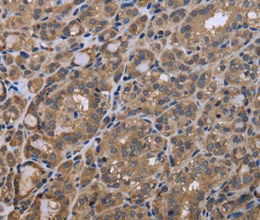Anti-Human/Mouse GADD45B Antibody