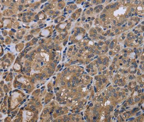 Anti-Human/Mouse GADD45B Antibody - ABMIUM