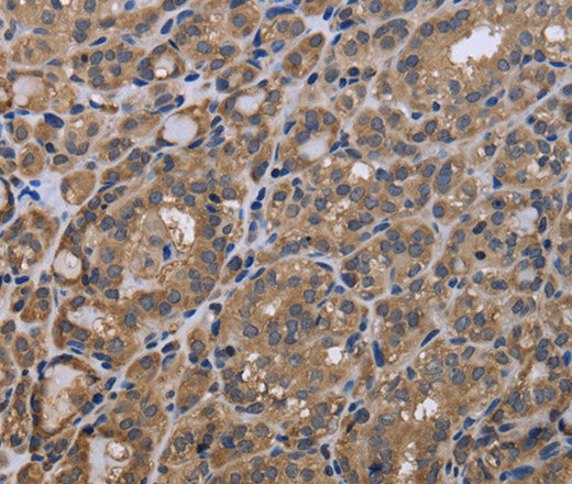 Anti-Human/Mouse GADD45B Antibody - ABMIUM