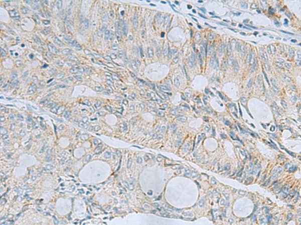 Anti-Human MSI2 Antibody