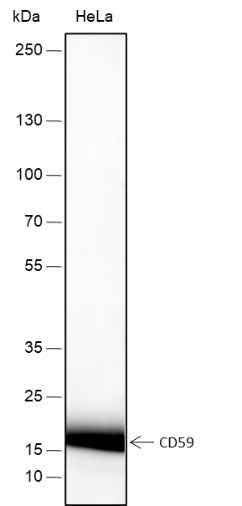 Anti-Human CD59 Antibody [A178] - ABMIUM