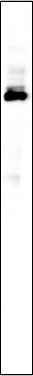 Anti-Human BRAT1 Antibody [B984] - ABMIUM