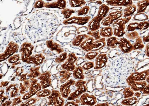 Anti-Human XPNPEP2 Antibody [A1194] - ABMIUM