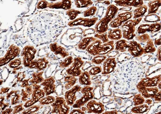 Anti-Human XPNPEP2 Antibody [A1194] - ABMIUM