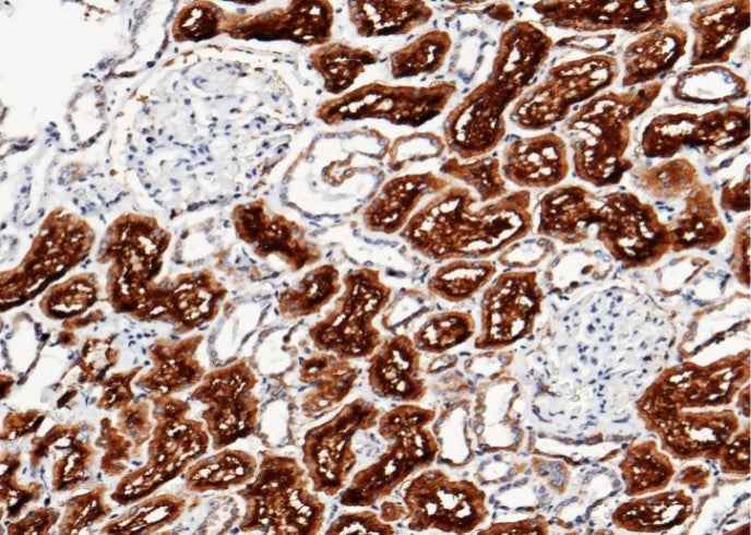 Anti-Human XPNPEP2 Antibody [A1194] - ABMIUM