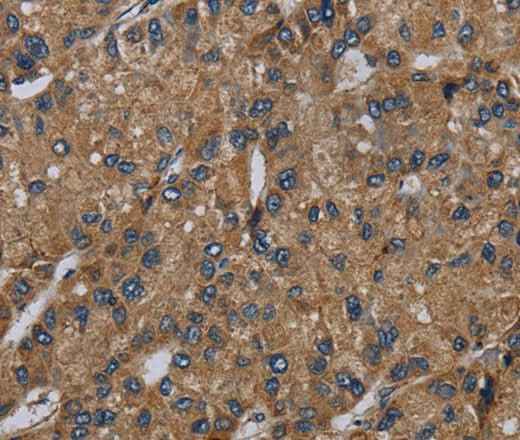 Anti-Human/Mouse/Rat NDUFS6 Antibody