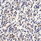 Immunohistochemistry analysis of paraffin-embedded Human tonsil using p21 Polyclonal Antibody at dilution of 1:300.