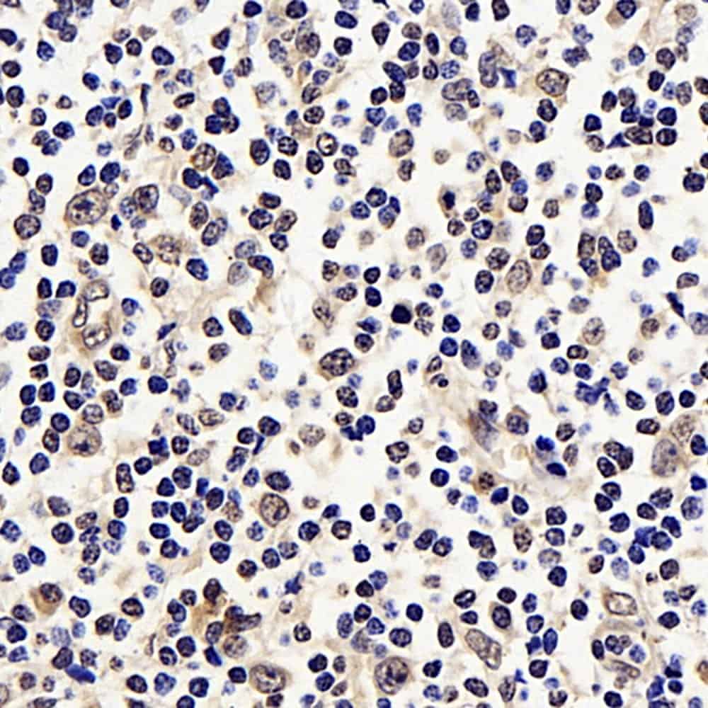 Immunohistochemistry analysis of paraffin-embedded Human tonsil using p21 Polyclonal Antibody at dilution of 1:300.