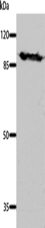 Anti-Human/Mouse/Rat DNM1 Antibody - ABMIUM