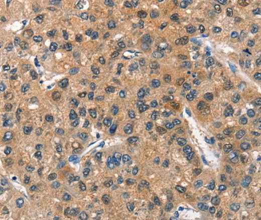 Anti-Human/Mouse/Rat ASB2 Antibody