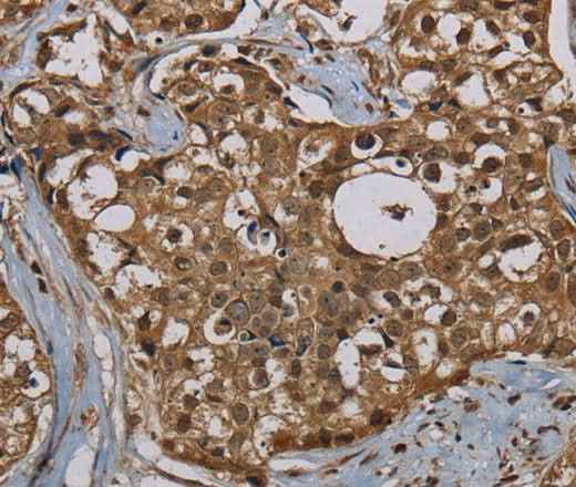 Anti-Human/Mouse PNN Antibody