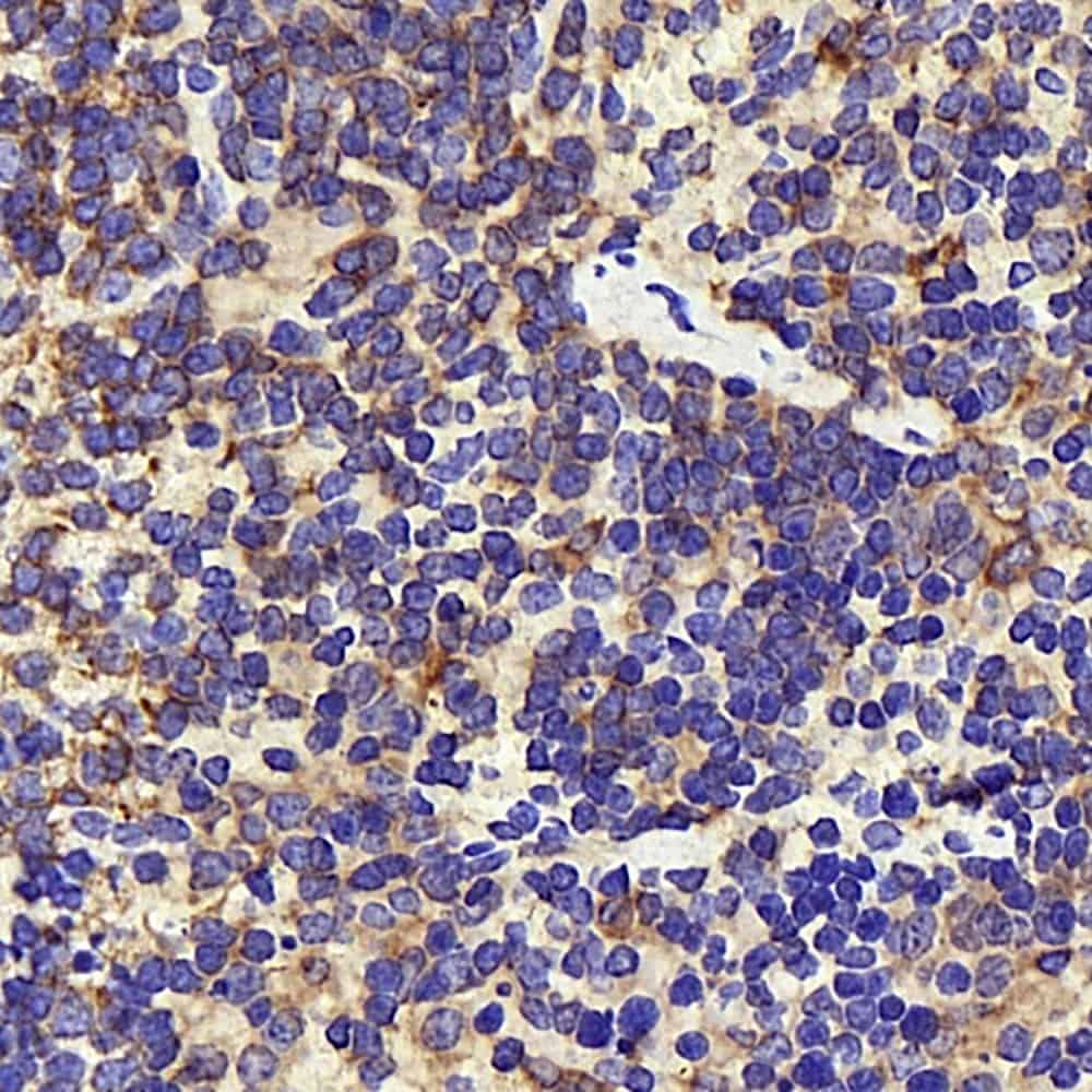 Immunohistochemistry analysis of paraffin-embedded mouse inflammation spleen using INPP5D Polyclonal Antibody at dilution of 1:300.