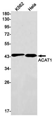 Western blot detection of ACAT1 in K562,Hela cell lysates using ACAT1 Rabbit mAb(1:1000 diluted).Predicted band size:45kDa.Observed band size:45kDa.