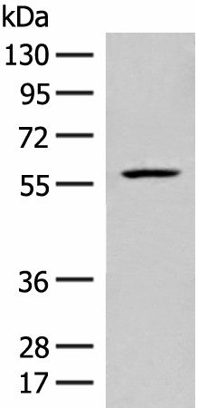 Western blot analysis of Mouse liver tissue lysate using FKTN Polyclonal Antibody at dilution of 1:450