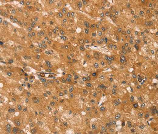 Anti-Human/Mouse/Rat SNAP29 Antibody