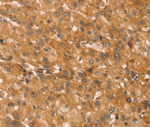 Anti-Human/Mouse/Rat SNAP29 Antibody - ABMIUM
