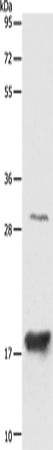 Anti-Human/Mouse AGR2 Antibody - ABMIUM