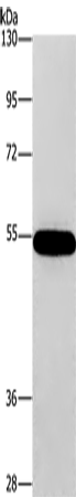 Anti-Human/Mouse/Rat CNDP1 Antibody - ABMIUM