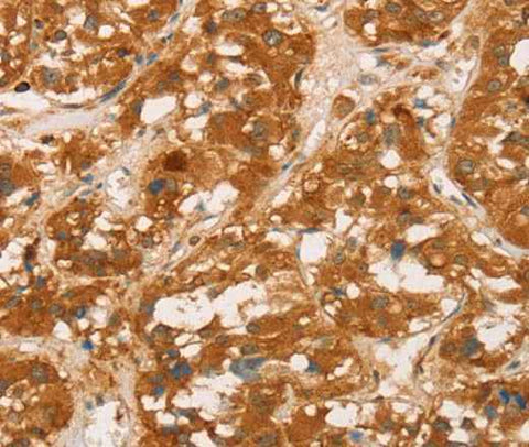 Anti-Human SPN Antibody