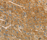 Anti-Human VTN Antibody - ABMIUM