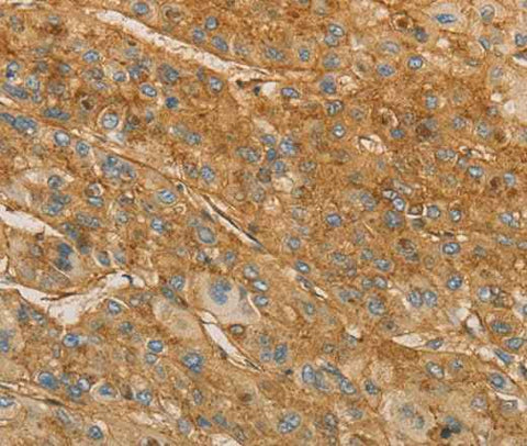 Anti-Human VTN Antibody