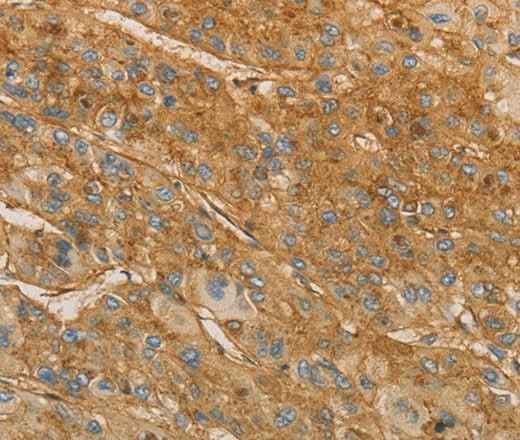 Anti-Human VTN Antibody