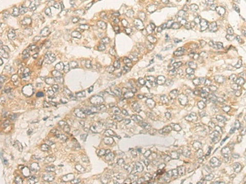 Anti-Human/Rat DUOX2 Antibody - ABMIUM