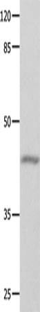 Anti-Human/Mouse/Rat GNA11 Antibody - ABMIUM