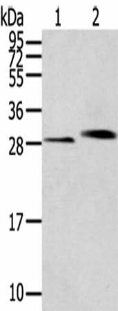 Western blot analysis of Human normal kidney tissue Human liver tissue using CLIC4 Polyclonal Antibody at dilution of 1:200