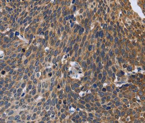 Anti-Human/Mouse GABPB2 Antibody - ABMIUM