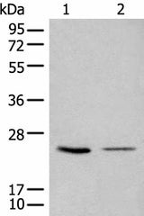 Western blot analysis of 293T and LOVO cell lysates using CDCA4 Polyclonal Antibody at dilution of 1:1000