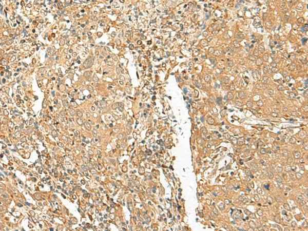 Anti-Human GOLGA6A Antibody