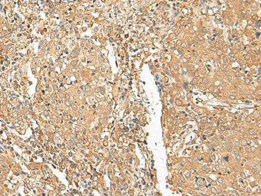 Anti-Human GOLGA6A Antibody