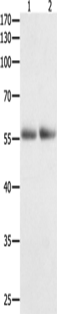 Anti-Human/Mouse/Rat HDAC1 Antibody - ABMIUM